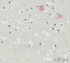 剛果紅染色