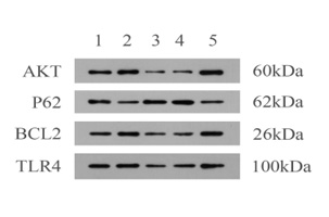Western Blot：探索蛋白質(zhì)表達與相互作用的有力工具