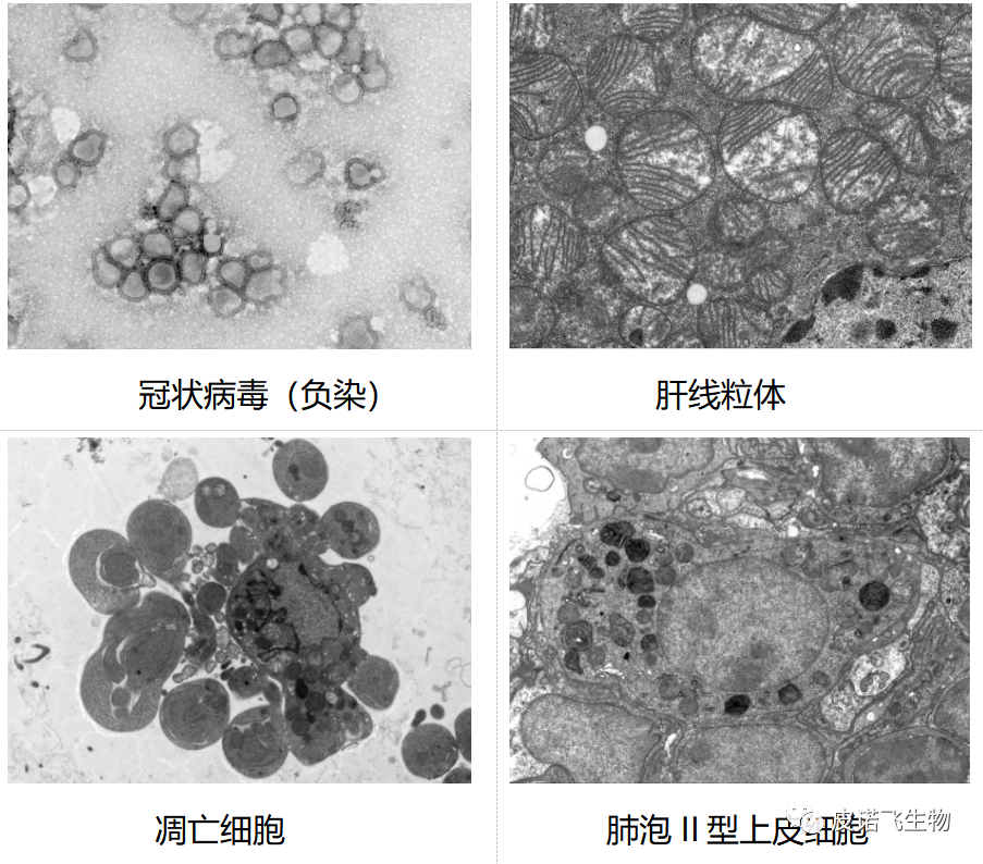 探索微觀世界，透射電鏡的應(yīng)用與原理