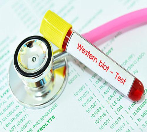 皮諾飛生物Western Blot檢測(cè)：探索蛋白質(zhì)表達(dá)的新境界