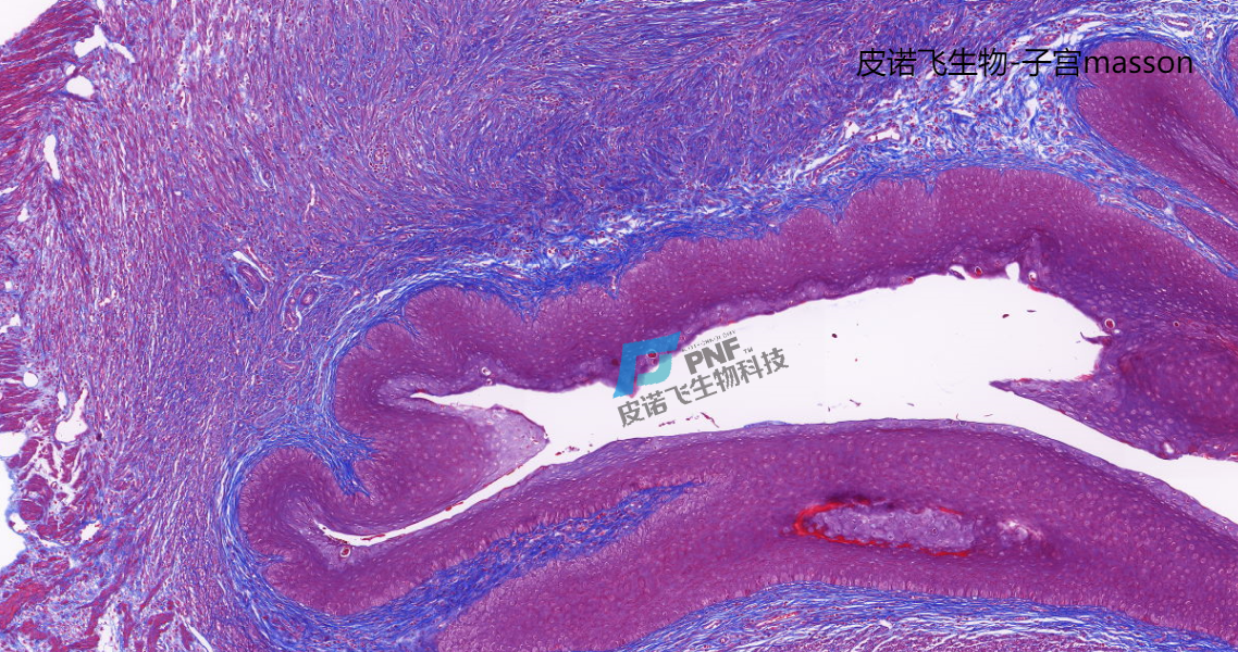 皮諾飛生物病理實驗Masson染色實驗方法