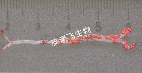 大體油紅 主動(dòng)脈