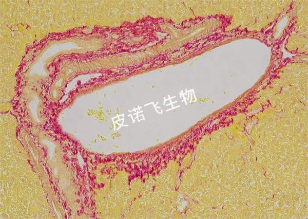 天狼猩紅 肝