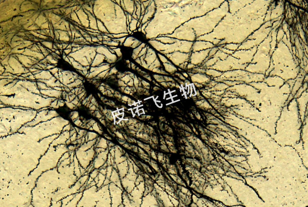高爾基 腦