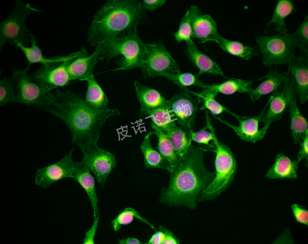 a-Actin 綠 ；PCNA 紅