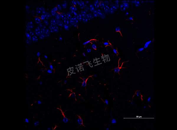 腦 GFAP紅 600-1_RGB