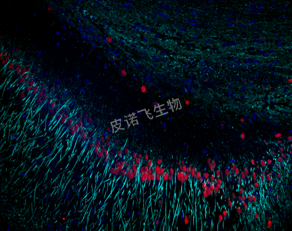 β-Tubulin 青； Neun 紅