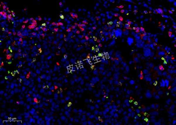 CD8綠+CD4紅 肝