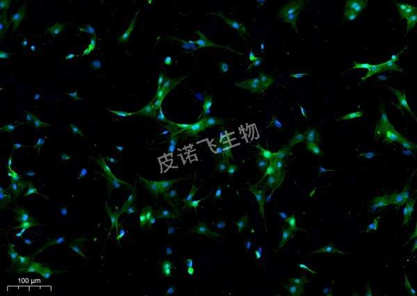 CTNT綠_ 細(xì)胞爬片