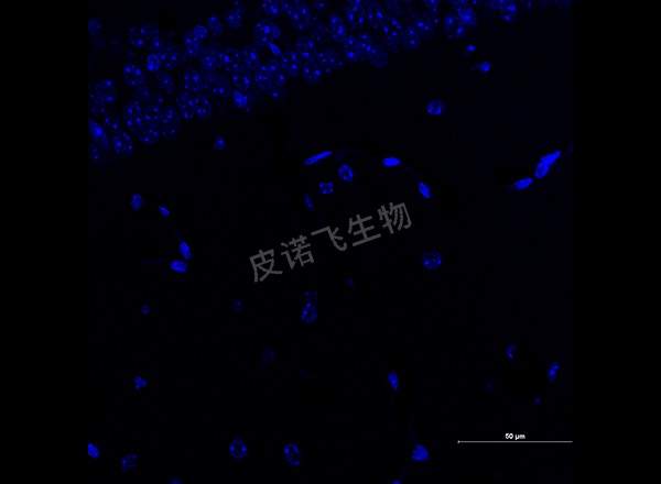 腦 GFAP紅 600-1_RGB_DAPI