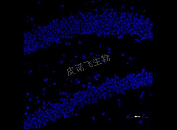 腦 neun紅+iba-1綠 400-1_RGB_DAPI