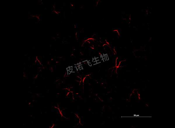 腦 GFAP紅 600-1_RGB_CY3