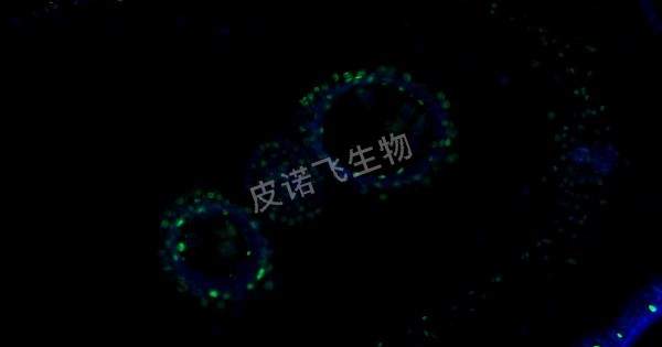 植物花藥 tunel綠