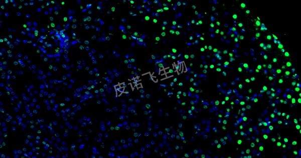 腎 tunel綠