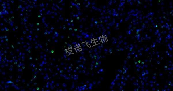 肝 tunel 綠