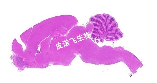 矢狀腦_HE
