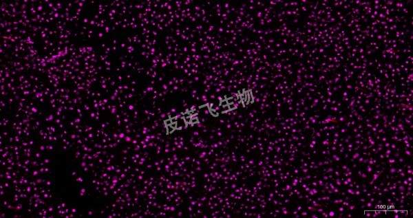 腫瘤 ros