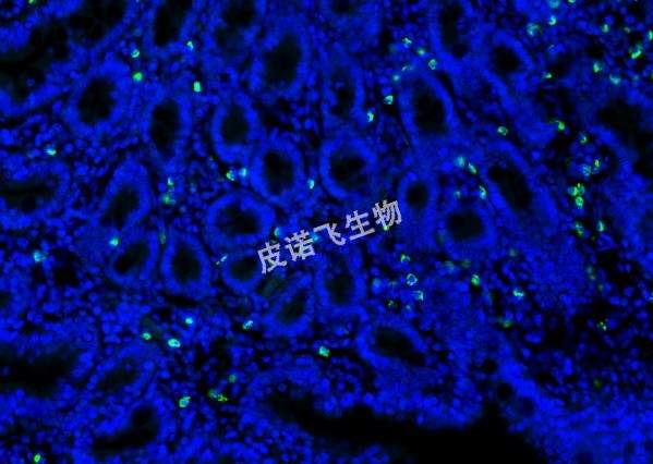CD68探針綠 腸_40.0x