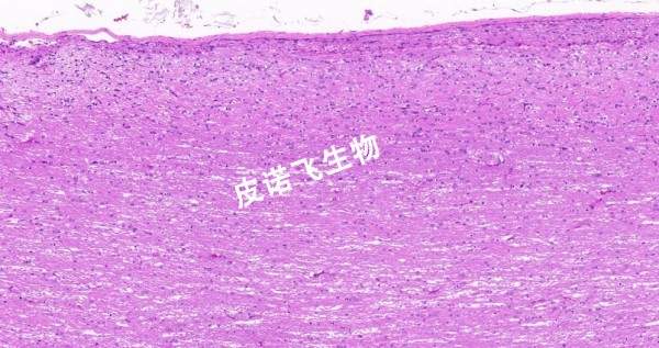 脊髓縱_HE
