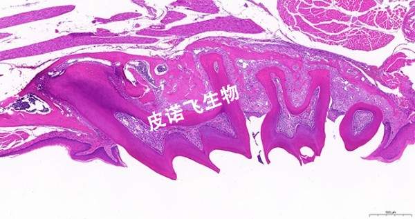 牙齒-HE