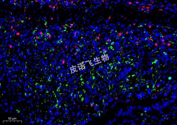GPX4綠+miRNA紅 腸_40.0x