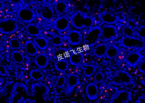 CD163探針 腸_40.0x
