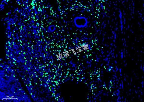 mRNA 綠 癌20.0x