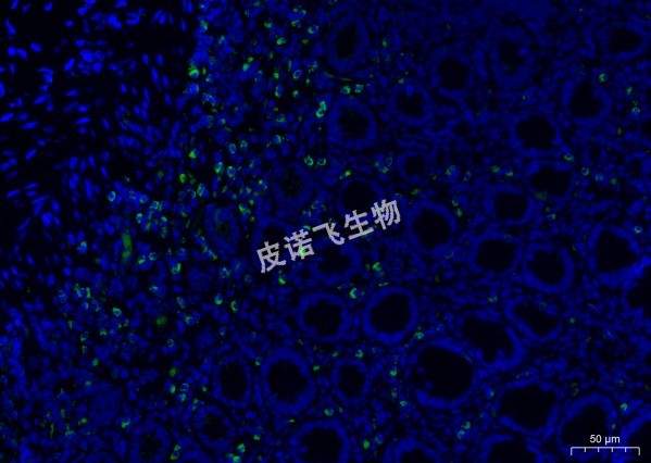 miRNA綠 腸_40.0x