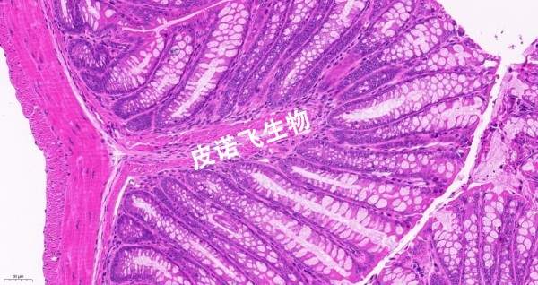 結(jié)腸HE