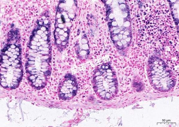 mi-RNA NBT顯色 腸_40.0x