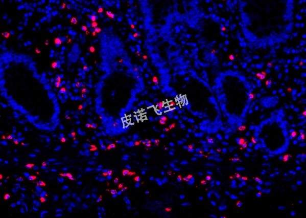 JPX紅_腸 40.0x