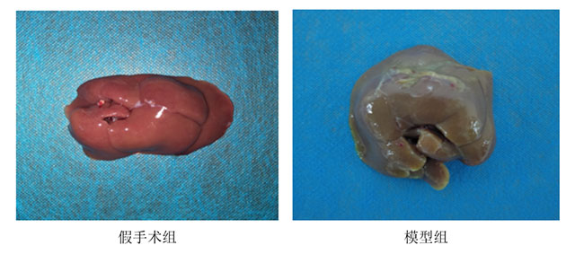 結(jié)扎膽總管構(gòu)建膽道梗阻再通模型