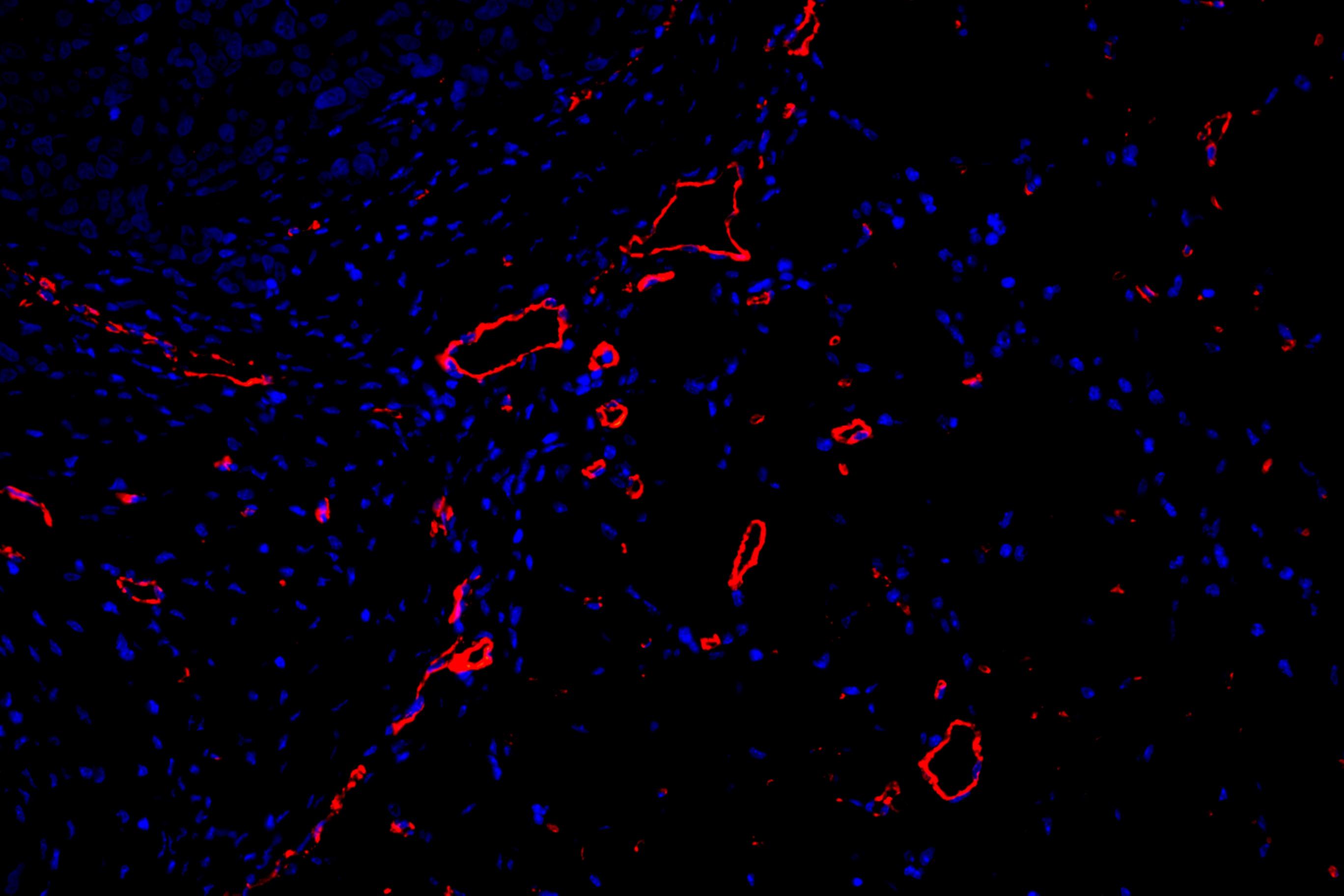 11腫瘤-200-3 cd31+dapi.jpg