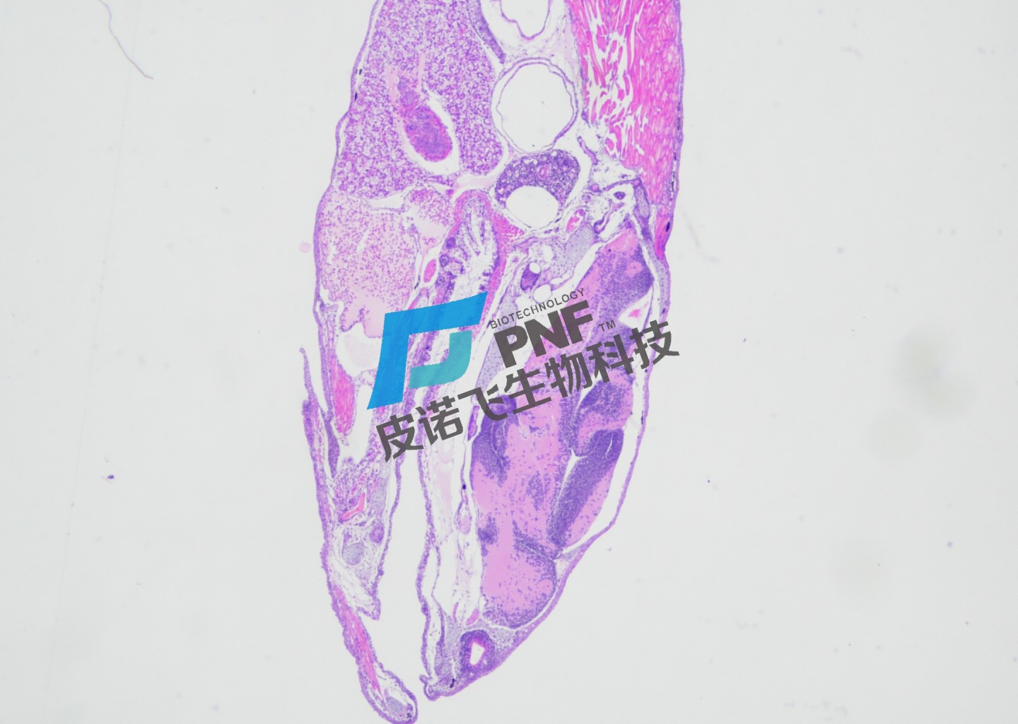 斑馬魚病理組織結(jié)構(gòu)探秘：深入了解健康與疾病的關(guān)鍵