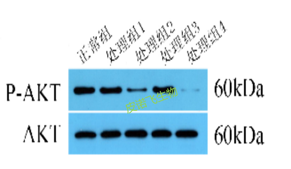 WB檢測(cè)公司：為您提供專業(yè)的生物技術(shù)檢測(cè)服務(wù)